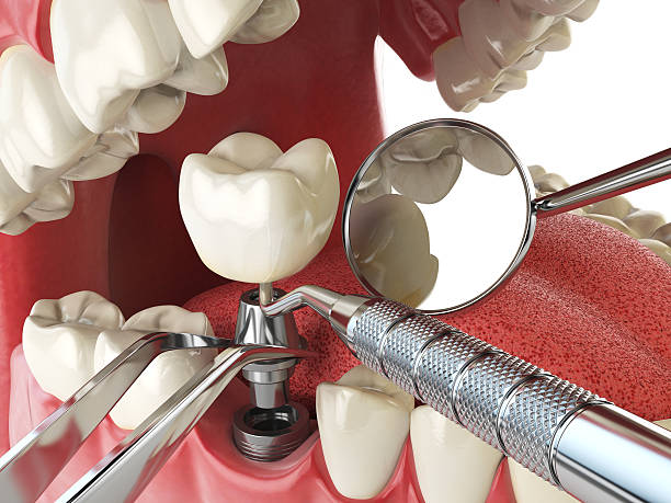 Best Emergency Root Canal Treatment in Fairfield Plantation, GA